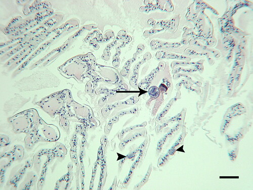 Figure 14. Gill tissue from Litopenaeus setiferus collected before visible black gill occurred in the population. Arrow indicates a ciliate associated with small amounts of tissue necrosis and melanization. Arrowheads indicate small ciliates which have not induced a host cellular response. H & E. Scale bar 100 µm.