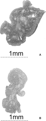 FIG. 2 Representative gestation day 18 fetal thymi, 40× magnification. (A) is a control thymus, while (B) is a 10 μg/kg TCDD-exposed thymus. Note the increased cellularity and size of the control thymus.