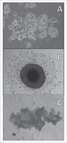 Figure 4. Light microscopy of a SCLC CTC tumorosphere. Adherent SCLC CTCs in tissue culture eventually start to form 3-dimensional structures under regular tissue culture conditions (A: BHGc10, left side of culture; magnification 100fold) which later grow into large tumorospheres (B: BHGc7, diameter of tumorosphere 560 µm; magnification 40fold). A large and irregular agglomeration of NCI-H526 cells in suspension is shown for comparison (C: magnification 40fold).