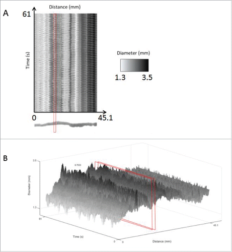 FIGURE 7. Spatiotemporal maps for data analysis of an untreated mouse small intestine. Using the motor analysis function, spatiotemporal motor maps of the mouse small intestine were generated and analyzed. (A) Two-dimensional spatiotemporal map: The software from the GIMM system includes the output of a spatiotemporal map recording distance, time and diameter measurements. This spatiotemporal map is used as the input for our analysis program. Distance is the x-axis, time is the y-axis and the diameter changes are recorded using shades from black to white. (B) Three-dimensional intensity map of the 3 variables, namely, distance, diameter and time, in the form of a 3D spatiotemporal plot. The area highlighted in red indicates the cross-section of the organ chosen, which we can see oscillates in diameter as contractions occur. This change in diameter over time is analyzed to measure frequency and amplitude of contractions. Diameters are represented in grayscale so that contractions were shown in black, relaxations are shown in white and the intermediate gray regions represent diameters from 0.7 mm to 5 mm as shown in the scale indicated by the red arrow.