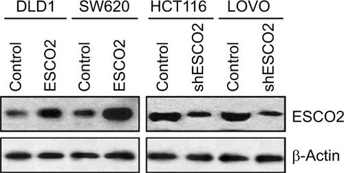 Figure S2 Western blot analysis to show the overexpression or silence of ESCO2 protein in CRC cell lines.Abbreviation: CRC, colorectal cancer.