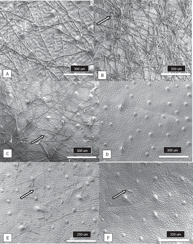 Fig. 9 Scanning electron microscopic images showing growth of the powdery mildew pathogen on leaf surfaces of untreated cannabis plants or following applications of disease management products. Weekly applications of three products or daily exposure of plants to UV-C light were made as indicated. Samples were collected after four applications of products or following a 28-day exposure to UV-C light. (a) Mycelium of a young developing colony on an untreated leaf. (b) Mycelium and spore production (arrow) of a mature colony on an untreated leaf. (c) Reduced mycelial growth on the leaf surface, with some sporulation (arrow) following applications of Rhapsody. (d) Total absence of mycelial growth on the leaf surface following applications of Regalia®. Hair-like projections that are visible are the trichomes. (e) Sparse mycelial growth and collapsed conidia (arrow) following applications of MilStop®. (f) Total absence of mycelial growth following daily exposure to UV-C light. Arrow shows conidia attempting to germinate
