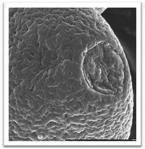 Figure 2. Pollen exine ornamentation image