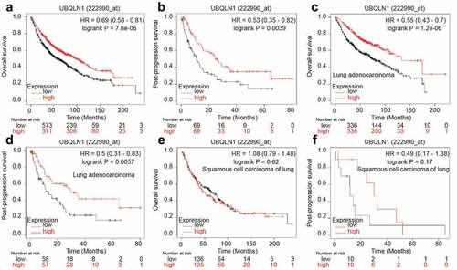 Figure 6. UBQLN1 predicts a longer survival in lung adenocarcinoma patients, but not squamous cell carcinoma of lung patients. (a) The correlation between UBQLN1 mRNA level and overall survival of lung cancer patients was evaluated through online dataset analysis. (b) The correlation between UBQLN1 mRNA level and post-progression survival of lung cancer patients was analyzed through online dataset analysis. (c and d) The correlation between UBQLN1 mRNA level and overall survival, post-progression survival of lung adenocarcinoma cancer patients was examined through online dataset analysis. (e and f) The correlation between UBQLN1 mRNA level and overall survival, post-progression survival of squamous cell carcinoma of lung patients was examined through online dataset analysis