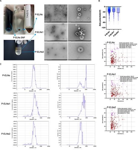 Figure 1 Characterization of P-ELNs, P-ELNs1, and P-ELNs2, Extract photos ((A), left), TEM images ((A), right), ζ potential (B), and NTA (C). TEM images include scale bars of 1 μm and 200 nm.