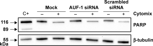 Figure S4 Evaluation of treatment-induced apoptosis in BEAS-2B cells following AUF-1 silencing.Notes: Western blot analysis of PARP expression in whole cell lysates obtained from BEAS-2B cells untreated and stimulated 48 hours with cytomix following transfection with AUF-1 siRNA, scrambled siRNA, and mock transfection (Fugene) (mean ± SEM of n=4). Positive control (Ctrl) showing cleaved PARP protein band is whole cell lysate of gefitinib-treated H1975 NSCLC cell line. Representative immunoblots of n=3 independent experiments are shown. β-Tubulin is shown as loading control.Abbreviations: AUF-1, AU-rich element-binding factor 1; NLF, normal lung function; SEM, standard error of mean; NSCLC, non-small-cell lung cancer.