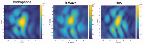 Figure 3. Pressure patterns (in Pa) in the transverse plane centered on the geometric focus comparing the hydrophone measurement results with k-Wave and HAS simulations of the ultrasound beam after propagation through one of the heterogeneous P-Type phantoms.