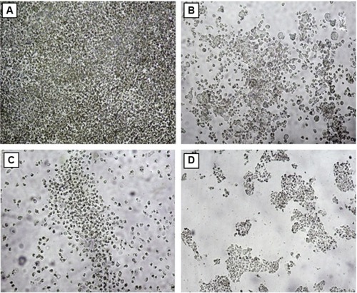 Figure 8 Inverted microscopic image of HT29 (A) control cells, (B) Gymnema sylvestre-treated (85 μg/mL), (C) silver nanoparticle-treated (83 μg/mL), and (D) silver nanoparticle-treated (85 μg/mL) cells.