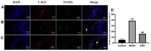 Figure 6 Results of ICC and TUNEL fluorescence staining in the SO tissue of rabbits (400×, 20 um); Blue is DAPI staining, red is c-kit positive ICC cell staining, green is TUNEL apoptotic cell staining. (A) Normal group, (B) Model group, (C) Treatment group, (D) ICC double positive expression rate. The model group vs the control group, ***P ≤ 0.001. The SGD group vs the model group, ###P ≤ 0.001. Arrows indicate positive expression.