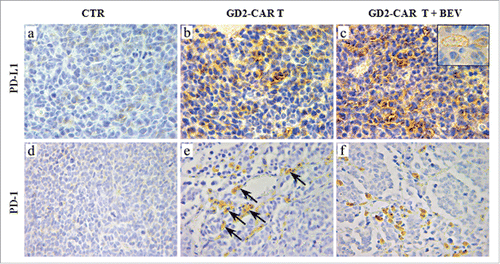 Figure 6. PD-L1 and PD-1 expression in tumors developed in Scid/Beige mice orthotopically engrafted with HTLA-230 NB cells and treated GD2-CAR T cells alone or combined with BEV. PD-L1 and PD-1 immunostaining of tumors from mice either untreated (a, d, CTR) or treated with GD2-CAR T cells alone (b, e) or in combination with BEV (c, f). PD-L1 expression involved tumor cells and, sometimes, vascular endothelial cells (c, inset panel), whereas PD-1 was expressed by tumor infiltrating lymphocyte-like cells. PD-1+ cells were detected mainly at the tumor edge after administration of GD2-CAR T cells alone (arrows in e), while they were observed penetrating throughout the tumor after the combined treatment with GD2-CAR T cells and BEV. (a, b, c and inset: X630; d, e, f: X400).