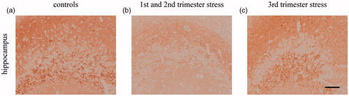 Figure 4. Effects of chronic maternal stress on synaptic density in frontal cortex of the fetal sheep brain at 0.87 gestation. Representative photomicrographs of synaptophysin immunohistochemistry (brown precipitation) of the CA3 region of the hippocampus (a–c). Stress during the first and second trimester but not stress during the third trimester reduced synaptophysin IR. Scale bar 100 µm.
