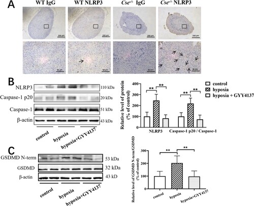 Figure 2. Hypoxia causes NLRP3 inflammasome activation and pyroptosis in adrenal gland and GYY4137 treatment reverses them. (A) NLRP3 protein expression in the adrenal gland of WT and Cse-/- mice was analyzed by immunocytochemistry. Representative images of NLRP3 in the adrenal gland of WT and Cse-/- mice. Arrows indicate NLRP3-positive staining. (B and C) WT mice with hypoxia for 72 h were treated with GYY4137 at the dose of 133 μmol/kg/day. The levels of NLRP3, Caspase-1 and cleaved caspase-1 p20 (B) and the levels of GSDMD and GSDMD N-terminal (C) in adrenal glands of the mice with or without GYY4137 treatment were determined by western blotting analysis. Data were expressed as mean ± SEM. n = 8 in each group. **P < 0.01.