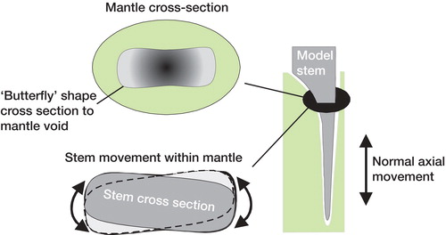 Figure 1. Schematic diagram of the mantle void profile created by the formers, demonstrating the increased rotational movement and unchanged axial movement of the stem.