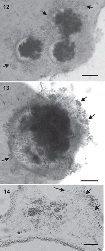 Figs 12–14. Kallymenia ercegovicii Vergés & Le Gall, sp. nov. (PC0152698): Cystocarps. Scale bar = 200 µm (Figs 11, 12), 100 µm (Fig. 13). Figs 12–13. Carposporophytes in surface view with fragmented involucre (arrows). Fig. 14. Cross-section of a carposporophyte showing the fascicles of the involucre (arrows).