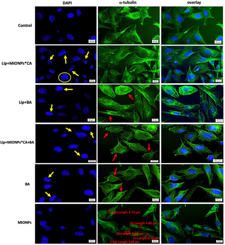 Figure 8 MDA-MB-231 cells visualized by fluorescence microscopy, after 24 h treatment with test compounds at concentration of 25 µM, under hyperthermal conditions. Nuclear and microtubules staining were expressed separately (DAPI and α-tubulin, respectively) and also combined (overlay). Yellow arrows marked the typical morphological changes for apoptosis induction: chromatin condensation, boundary alterations, and nuclear fragmentation, while enucleation process is highlighted by the yellow circle. The abnormal filamentous organization of microtubule (MT) network was indicated by the red arrows. Three independent experiments were performed for each sample (n=3).