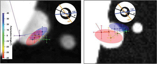 Figure 7. Polarization-dependent localization imaging of an ideal (left) and non-ideal (right) gold nanoparticle trimer. Colored markers represent localization spots determined with NOLES imaging with 1-σ confidence levels as error bars. The color of the marker identifies the incident polarization angle of the fundamental source with respect to the inter-particle axis. The figures in the inset indicate how the polarization angles orient with respect to the full nanoassembly. The red and blue shaded regions indicate where the localization centers clustered at the extremes of the polarization rotation. Adapted with permission from reference 28