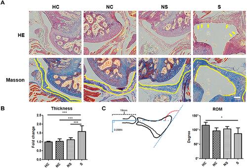 Figure 3 The impact of different injection materials on the histological and biomechanical appearance of mice shoulders with immobilization. (A) The representative image of joint capsule of the shoulder on HE staining and Masson staining. (B) The quantification of capsule thickness and inter-group comparison. (C) The schematic image of the method to measure passive range of motion and the quantification. The yellow arrow in A indicated the hypercellular status of joint capsule. The yellow line in A indicated the inner and outer border of joint capsule. The red dotted arch indicated the angle of the glenohumeral joint under a certain torque, which represented the range of motion to be measured. N=7. *p<0.05, ***p<0.001. Bar: 200μm.