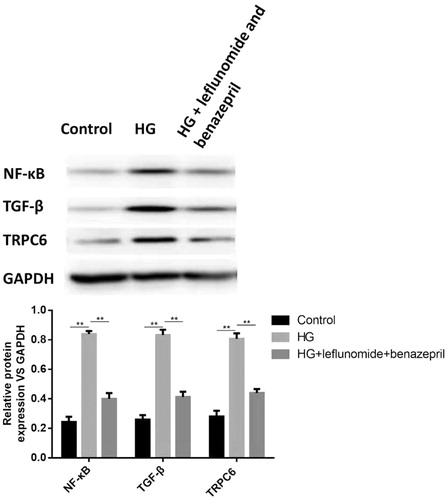 Figure 4. Protein expression of NF-κB, TGF-β and TRPC6 in different groups of RMCs and the quantified results. The expression levels of NF-κB, TGF-β and TRPC6 were significantly increased when cells were treated with high glucose. When treated with leflunomide and benazepril, the protein levels NF-κB, TGF-β and TRPC6 were dramatically decreased.