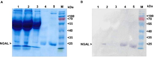 Figure 3. Identification of NGAL protein. (A) SDS-PAGE. Each sample was analyzed under reducing conditions. Lane 1: culture medium control, lane 2: pre-purified supernatant, lane 3: flow-through fraction, lane 4: first eluted fraction, lane 5: second eluted fraction, M: protein marker (kDa) (Thermo Fisher Scientific, Vilnius, Lithuania, cat. no. 26616). (B) Western blotting. The membrane was probed using an anti-His monoclonal antibody.