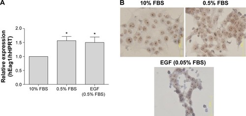 Figure 3 Serum deprivation up-regulates ether à-go-go-1 (Eag1) expression in breast cancer cells.