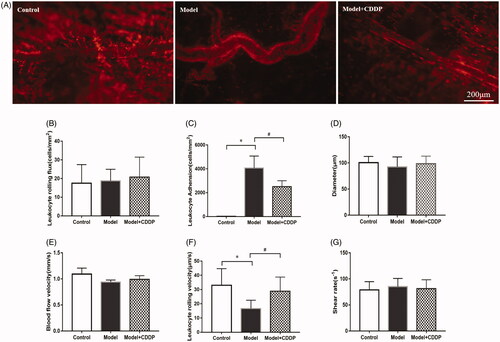 Figure 3. Pre-treatment with CDDP reduced leukocytes adhesion. Data are mean ± SD from 10 mice. *p < 0.05, model vs. control group. #p < 0.05, model vs. model + CDDP group.