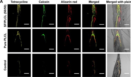 Figure 6 Fluorochrome labeling analysis of new bone formation and mineralization.Notes: (A) Row 1 (yellow) shows tetracycline labeling at week 2; row 2 (green) shows calcein at week 4; row 3 (red) shows alizarin red at week 6; row 4 shows merged images of the three fluorochromes for the same group; and row 5 shows merged images of the three fluorochromes with the plain image for each group. (B) The percentages of each fluorochrome area for the different groups showed significant differences among the SF/PLCL (50/50), pure PLCL, and control groups. *P<0.05, **P<0.01. Abbreviations: PLCL, poly(lactide-co-ε-caprolactone); SF, silk fibroin.