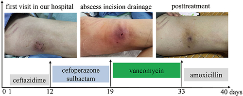 Figure 1 The time course of treatment and states of illness.