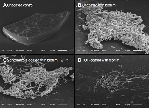 Figure 2 Coating catheter with Tryptophol (TOH) significantly reduced the intraluminal biofilm formation of Scedosporium apiospermum CBS 11741 (108 conidia/mL) after 48 h post-inoculation as observed under a scanning electron microscope (SEM). Scanning electron micrograph in the luminal surface of (A) uncoated catheter, (B) uncoated catheter with S. apiospermum, (C) voriconazole-coated-catheter (100 μM) with S. apiospermum, and (D) TOH-coated-catheter (100 μM) with S. apiospermum. Scale bar (A–D) = 20 μm.