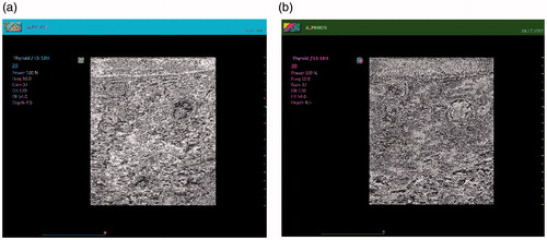 Figure 4. DICOM images after (a) conventional RSA algorithm and (b) modified RSA algorithm using Mersenne prime numbers.