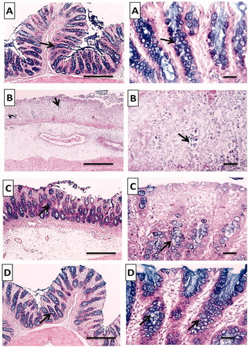 Figure 12. Histochemical examination (Alcian blue stain) of colonic tissues after acetic acid-induced colitis in rats to detect colonic mucus. (A) Normal group; (B) positive control group; (C) TMB group; (D) TMB-NLC group. Magnification, ×100/scale bar = 100 μm (left side) and ×400/scale bar = 50 μm (right side). Goblet cells lining crypts (black arrow).