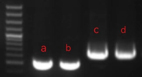 Figure 6. GAP-PCR results of Proband 2 and its family lineage. I. Figure 6: I: a. Proband 2 promoter region and exon 1 PCR results. b. Proband 2’s mother region and exon 1 PCR results. c. Proband 2 exon 2 PCR results. d. Proband 2’s father exon 2 PCR results. (DNA Marker same as Figure 4 I)