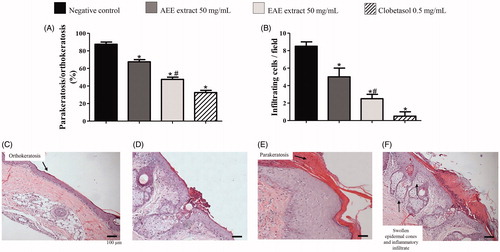 Figure 1. Data of microscopic evaluations (histology) of skin from the tails of rats with radiation-induced wounds that were treated with 50 mg/mL of AEE or EAE from the fruit of D. indica L. and the control groups. The analysis was performed in technical triplicates with samples of tissue of six mice from each group (biological replicates). The positive control was treated with clobetasol propionate (0.5 mg/mL), and the negative control was treated only with the excipient (1 mL of ethanol:water 1:2). (A) Percentage of parakeratosis compared to orthokeratosis and (B) quantification of infiltrating inflammatory cells. (C) Image of a slice of tissue from a positive control showing no parakeratosis (score 1) and, predominant orthokeratosis instead. (D) Images of tissues used to grade parakeratosis in comparison to orthokeratosis: minimum (score 2), (E) moderate (score 3). (F) Image of a slice of tissue from a negative control with intense parakeratosis (score 4) and swollen epidermal cones with inflammatory infiltrate. 400 × magnification (*) denotes significant difference compared to the negative control, p < 0.001. (#) denotes significant difference compared to AEE treatment, p < 0.05.