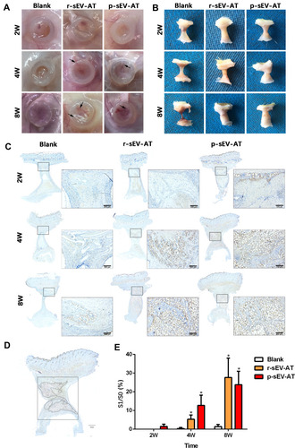Figure 4 Neoadipose tissue formation induced by xenogeneic and allogeneic sEV-AT in vivo. Macro images of the implants (A) with the tubes or (B) without the tubes in the blank, r-sEV-AT and p-sEV-AT groups at 2W, 4W and 8W. The black arrows pointed out the blood vessels. (C) Immature and mature adipocytes were confirmed by immunohistochemical staining (stained with adipocyte marker, perilipin A). Scale bar = 200 μm. (D) Selected sections represented the center of the implants, the dotted line represented the area of neoadipose tissue (S1), the solid line represented the longitudinal section area of the silicone tube (S0), and S1/S0 represented the proportion of the neoadipose tissue in the silicone tube. (E) The average of S1/S0 in different groups (n=3). The significance was tested with one-way ANOVA with Tukey posthoc test (*p<0.05).Abbreviations: p-sEV-AT, small extracellular vesicles derived from porcine adipose tissue; r-sEV-AT, small extracellular vesicles derived from rat adipose tissue; sEV-AT, small extracellular vesicles derived from adipose tissue.