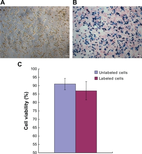 Figure 6 Nano iron particle labeling of endothelial progenitor cells. A) The cytochylema in Resovist-labeled cells contained brown-colored granules. B) Prussian blue staining for iron showed the cytosolic deposition of blue crystals. C) A trypan blue cell viability assay revealed no significant difference between unlabeled cells and iron-labeled cells.Note: Magnification: ×100.