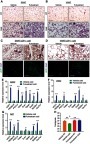 Figure 5 Chronic Fulvestrant treatment enhances cold-induced beiging. Chronic administration, as described in Figure 4A. (A–B) Representative H&E-stained histological sections of SWAT (A) and VWAT (B), n≥7. (C–D) UCP1 immunohistochemistry (upper lane) and immunofluorescence (lower lane) - representative sections of SWAT (C) and VWAT (D) at cold. (E–G) Relative mRNA levels, quantified by qPCR, of brown/beige adipocyte markers expressed in SWAT (IGW) (E), VWAT (PGW) (F) and BAT (G) at cold, n≥8. (H) Body temperature (rectal probe) of vehicle-treated and Fulvestrant-treated females at RT and cold, n≥6. Scale bars =100 µm. Error bars indicate S.E.M. Statistical significance assessed by two-tailed Student’s t-test, *p<0.05, **p<0.01; and one-way ANOVA test, $p<0.01.