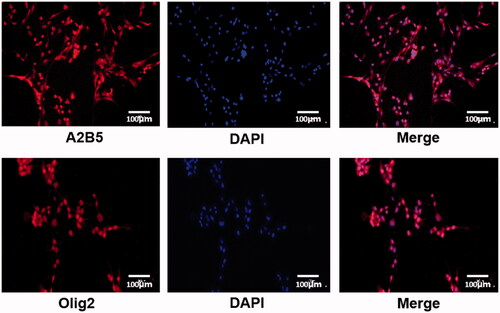 Figure 1. The identification of OPCs and OLs by immunofluorescent labeling of A2B5 and Olig2. Cell nuclei were stained by DAPI. Target proteins (A2B5 and Olig2) were labeled as red.