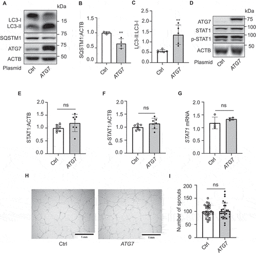 Figure 5. Overexpression of ATG7 does not affect STAT1 protein expression and tube formation. (a) HUVECs were transfected with MYC-control (Ctrl) or MYC-ATG7 (ATG7) plasmid for 24 h. (b and c) SQSTM1/p62 and MAP1LC3A/LC3-II:LC3-I protein expression was measured by western blot. Densitometric analysis of the blots, N = 4–5, ** P < 0.01. (d) STAT1 and phospho-STAT1 (Y701) protein levels were analyzed by western blot. (e and f) Densitometric analysis of the blots, N = 7, ns, not significant. (g) STAT1 mRNA level was determined in by RT-PCR. N = 4, ns, not significant. (h) Tube formation assay was performed 24 h after transfection of Ctrl or ATG7 plasmid, three independent experiments. (i) Quantitative analysis of sprout number, N = 28 fields, ns, not significant. Scale bar: 1 mm.
