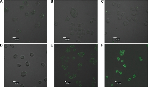 Figure 5 Confocal microscopy results. A549 cells (A and D) and SGC7901 cells (B, C, E, and F) were incubated with fluorescein isothiocyanate-labeled folate-conjugated human serum albumin nanoparticles or human serum albumin nanoparticles at indicated concentrations for four hours at 37°C. A) and B) 0.5 mg·mL−1 human serum albumin nanoparticles. C) 1 mg·mL−1 human serum albumin nanoparticles. D) and E) 0.5 mg·mL−1 folate-conjugated human serum albumin nanoparticles. F) 1 mg·mL−1 folateconjugated human serum albumin nanoparticles.