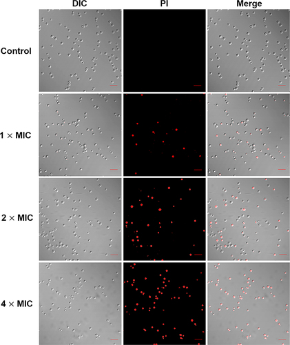 Figure 4 CLSM images of AMP-17 treated C. neoformans planktonic cells. C. neoformans planktonic cells were incubated with control and AMP-17 (1, 2 and 4× MIC) for 6 h at 35 °C. After staining with 10 μM propidium iodide (PI), the red fluorescence in samples was detected by CLSM at 530 nm and 590 nm of excitation and emission. One representative results out of two independent experiments is shown. Images were captured using a 600 × power field. Scale bar, 20 μm.