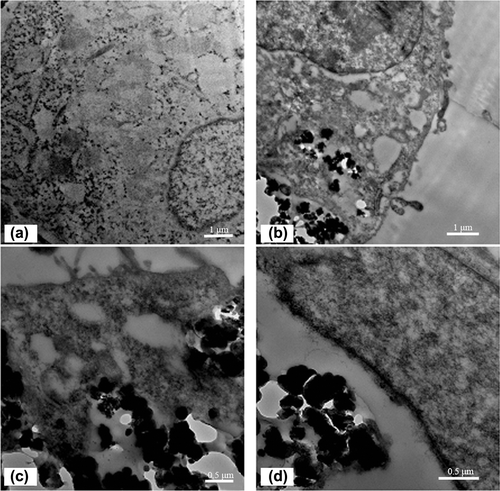 Figure 11. TEM image of the untreated (a) SMMC-7721; TEM images of SMMC-7721 after incubation with (b) MNPs, (c) FMNPs, and (d) FMNPs-BSA.