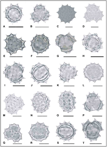 Figure 4. Light micrographs of pollen grains (×1000) Achillea magnifica (A, B) (from Arabacı 1465), (C, D) (from Arabacı 1497); Achillea tenuifolia (E, F) (from Arabacı 2582), (G, H) (from Arabacı 1619), (I, J) (from Arabacı 1618); Achillea phrygia (K, L) (from Yıldız 15258), (M, N) (from Arabacı 1530), (O, P) (from Arabacı 1480), (Q, R) (from Arabacı 2236); Achillea gypsicola (S, T) (from Arabacı 1560). Scale bars 20 μm.