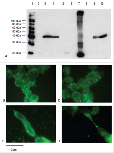 Figure 3. Expression of the E7*-CP proteins in HEK-293 cells upon transfection. A: Immunoblotting of proteins from lysates of 1×106 cells transfected with the E7*-CP fusions with or without ss. 1) Biotinylated Protein Ladder NEB; 2) E7* (cell lysate); 3) E7*-CP (cell lysate); 4) E7*-L-CP (cell lysate); 5) ss-E7* (cell lysate); 6) ss-E7*-CP (culture medium); 7) ss-E7 plant extract; 8) ss-E7*-L-CP (culture medium); 9) ss-E7*-CP (cell lysate); 10) ss-E7*-L-CP (cell lysate). B, C, D, E: Immunofluorescence (FITC) detected in cells transfected with E7*-CP (B, C) and E7*-L-CP (D,E) plasmids without or with the ss, respectively (original magnification, 100x; scale bar, 10 µm).