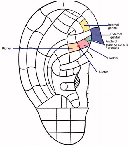 Figure 1. Selected ear acupoints for lower urinary tract symptoms.