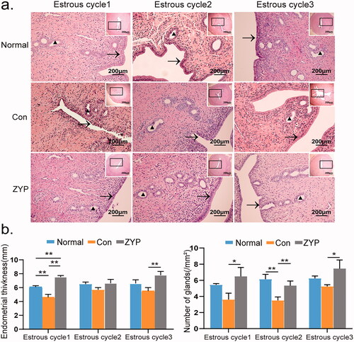 Figure 2. The morphological changes of rat endometrium in three groups. (*p < 0.05, **p < 0.01) (a) The morphological changes of the endometrium with Haematoxylin and Eosin Staining (×200). “→” indicates the endometrium structure, and “▲” represents endometrial glands. (b) Comparisons of endometrial thickness (mm) and endometrial gland numbers per unit area. Bar = 200 μm; Con: control; ZYP: Zishen Yutai Pill.