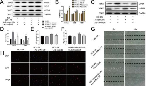 Figure 4 Sirt6 mediates EndMT via Notch1 signaling in CMECs. (A and B) Western blotting and quantitative analysis of Notch1, NICD, and HES-1 protein levels in CMECs treated as indicated (n = 5). (C and D) Western blotting and quantitative analysis of α-SMA and CD31 protein levels in CMECs treated as indicated (n = 5). (G and F) Scratch-migration assay and quantitative analysis in CMECs (n = 5). (H and E) EdU proliferation assay and quantitative analysis in CMECs (n = 5). *P < 0.05 vs HG+PA; #P < 0.05 vs HG+PA+ Ad-shNotch1; ^P < 0.05 vs HG+PA+Ad-shSirt6.