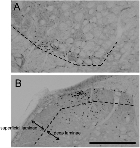 Figure 3. Photomicrographs of Fos-positive cells in vl-Vi/Vc (A). and caudal-Vc (B). region ipsilateral to masseter muscle injury with 5% formalin injection from FS rats. Scale bar = 0.2 mm.