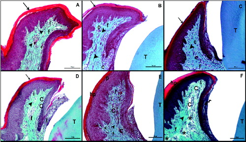 Figure 2. Masson trichrome (MT) staining after the induction of diabetes by streptozotocin. Histological images of the non-diabetic (control) rats: on day 7 (A), day 14 (B), day 21 (C); and diabetic rats: on day 7 (D), day 14 (E), day 21 (F). Tooth (T); corneum (arrow), capillary (C), fibroblasts (f), collagen (arrowhead), inflammatuar cells (i), parakeratosis (p), hyperkeratosis (hp), interepthlium inflammatory cell (curved arrow), disorganized structure of collagen fibres (*); scale bar: 50 μm.