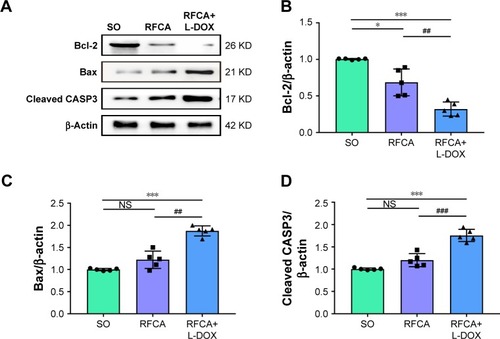 Figure 5 Expression level of apoptosis markers.Notes: (A) Western blotting results for markers of apoptosis in different groups. Quantitative measurements of the band intensities of Bcl-2 (B), Bax (C), and cleaved CASP3 (D) are shown, following normalization to β-actin. *P<0.05, ***P<0.001 vs SO treatment; ##P<0.01, ###P<0.001 vs RFCA treatment. n=5 per group, data are presented as means ± SD.Abbreviations: L-DOX, liposomal doxorubicin; NS, not significant; RFCA, radiofrequency catheter ablation; SO, sham-operated.