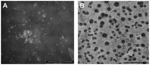 Figure 1 TEM images of (A) SLN-Q10 and (B) LIPO-Q10.Notes: (A) The bar is 1 μm. (B) The bar is 5 μm.Abbreviations: TEM, transmission electron microscopy; SLN-Q10, Q10-loaded solid lipid nanoparticles; LIPO-Q10, Q10-loaded liposomes.