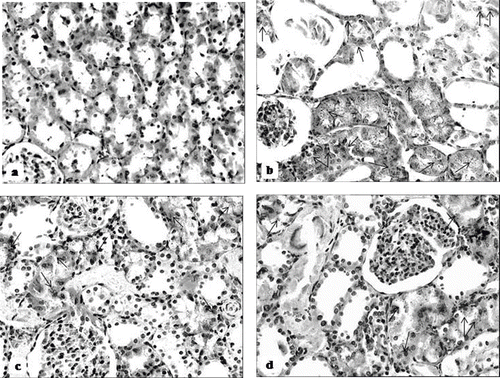 Figure 8. Iron-stained sections of rat kidneys (original magnification × 200). (a) There are no granular deposits in the control rat. (b) Kidney section of glycerol + saline-treated rat (ARF group). There are distinct granular deposits (arrows), showing iron accumulation. (c) Kidney section of glycerol + L-carnitine-treated rat, where L-carnitine was started at the same time as glycerol injection (ARF-LC group). The level of granular deposits (arrow) has decreased compared with the ARF group. (d) Kidney section of glycerol + L-carnitine-treated rats, where L-carnitine was started 48h before glycerol injection (ARF-proLC group). The level of granular deposits (arrow) has decreased compared with the ARF and ARF-LC group.